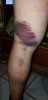 hamstring 1-10-19.jpg